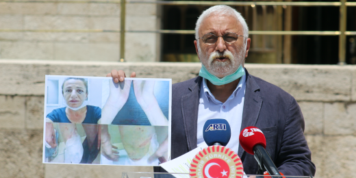 Oluç: İktidar, işkenceye tolerans dönemine geçti